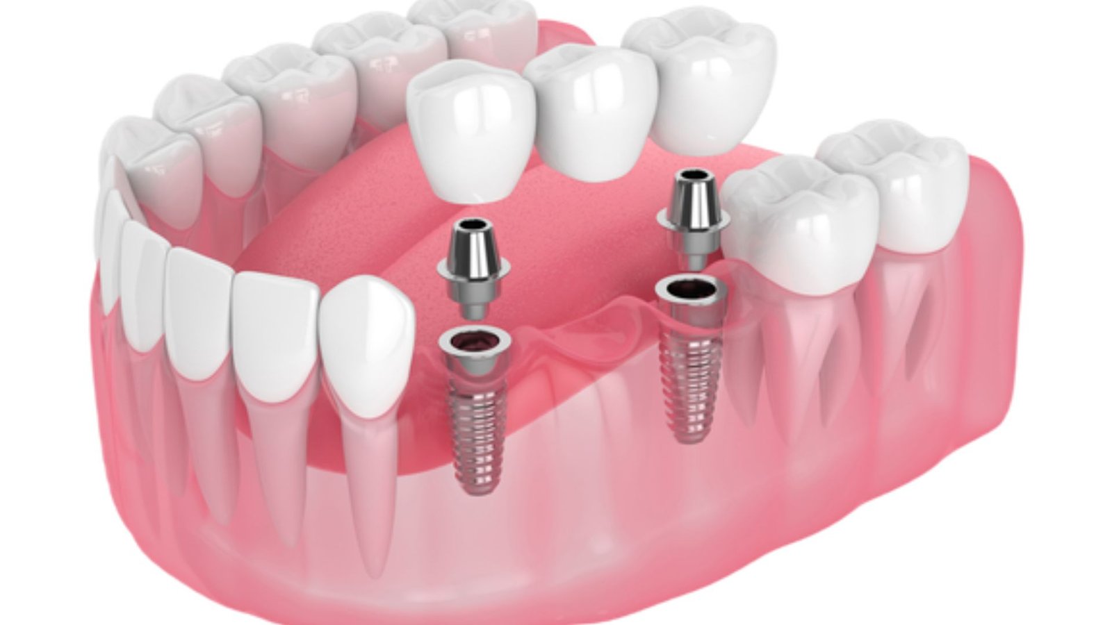 Affordable Oral Surgery Options Near Me