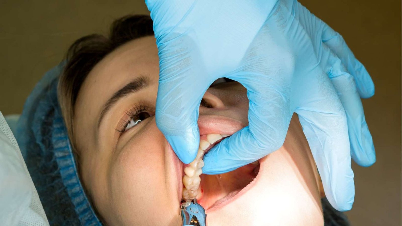 Best Oral Surgeons For Wisdom Teeth Removal