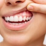 Common Oral Health Problems and How to Prevent Them