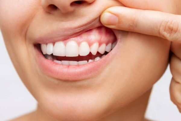 Common Oral Health Problems and How to Prevent Them