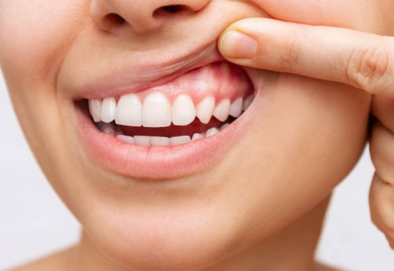 Common Oral Health Problems and How to Prevent Them