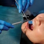 How Oral Surgery Can Help Improve Your Smile Aesthetics