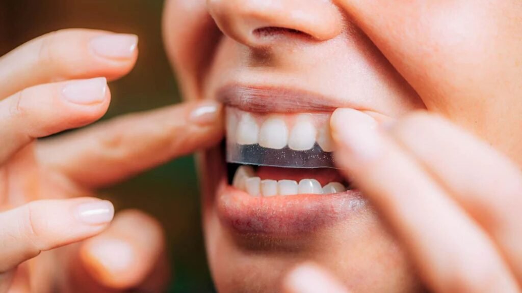 How to Avoid Tooth Sensitivity After Whitening Treatments