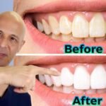 Natural Ways to Whiten Your Teeth: What Actually Works?