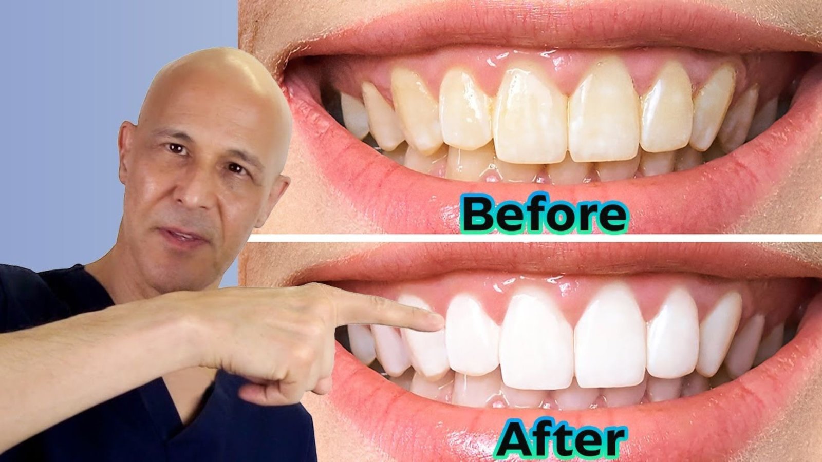 Natural Ways to Whiten Your Teeth: What Actually Works?