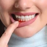 Oral Health Signs You Should Know