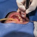 Preparing For Oral Surgery Appointment Tips