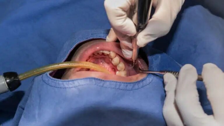 Preparing For Oral Surgery Appointment Tips