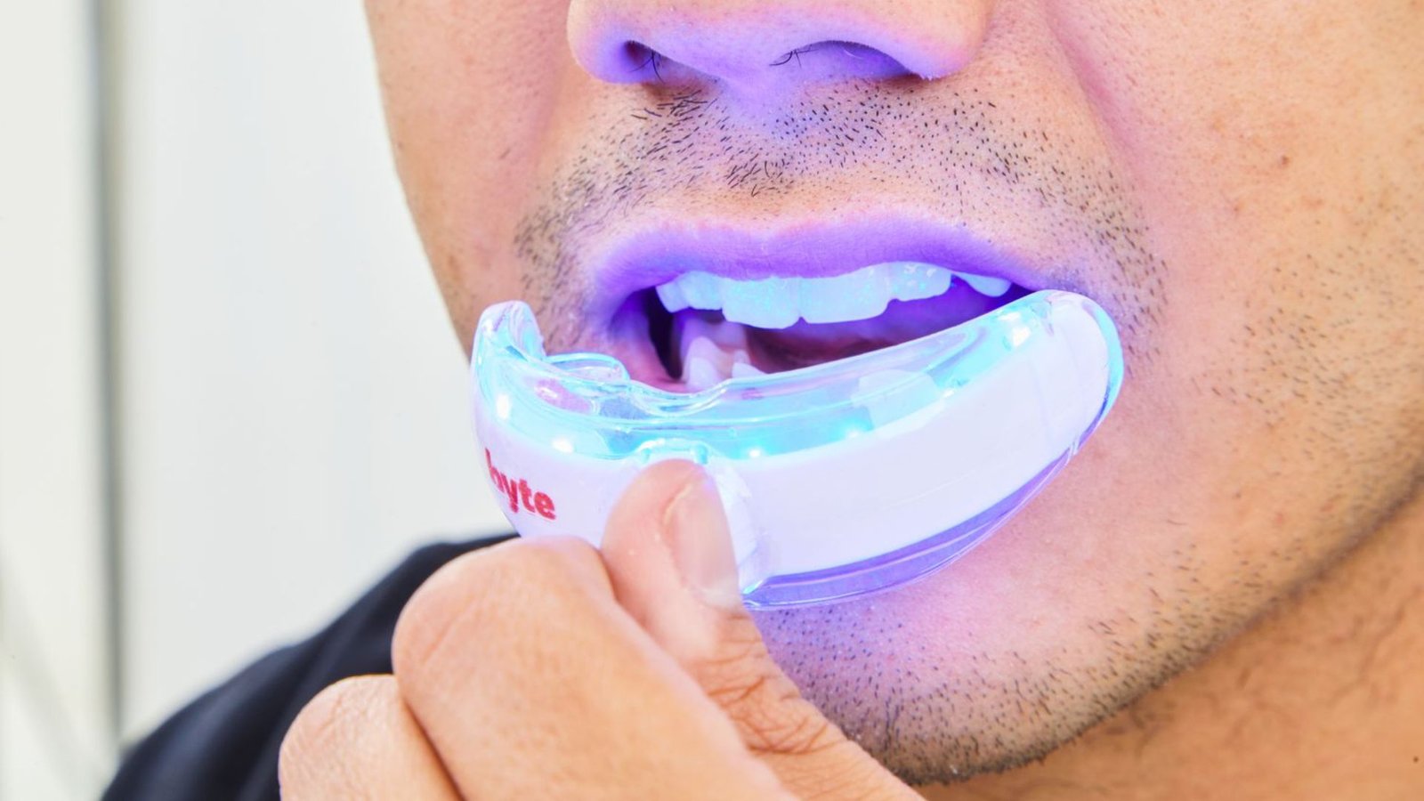 Professional Teeth Whitening Options For Sensitive Teeth