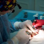 Risks and Benefits of Oral Surgery Explained