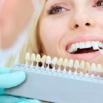 Teeth Whitening Products Recommended By Dentists