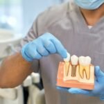 The Benefits of Oral Surgery for Addressing Jaw Problems
