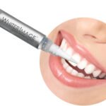 The Cost of Professional Teeth Whitening vs. Over-the-Counter Products