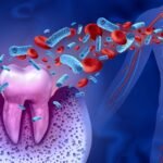 The Effects of Poor Oral Hygiene on Your Heart Health