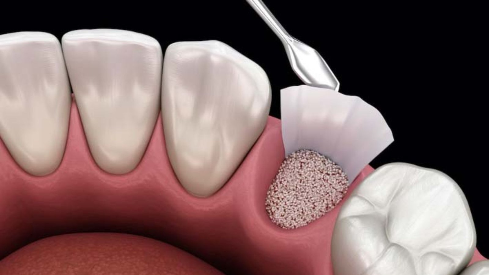 The Most Common Types of Oral Surgery Procedures