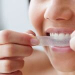 The Pros and Cons of Whitening Strips and Gels