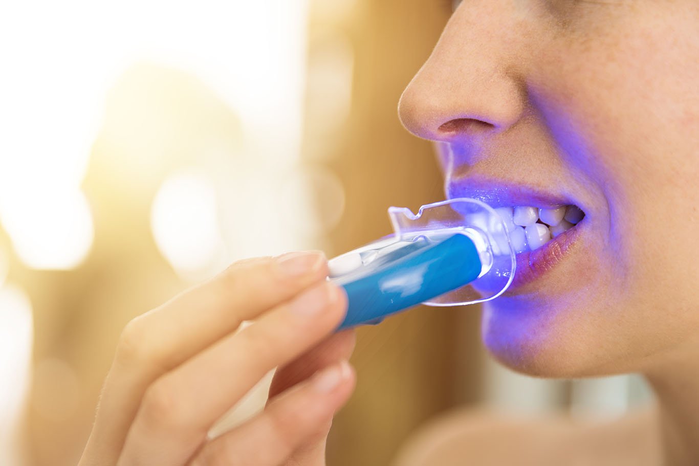 The Science Behind Teeth Whitening