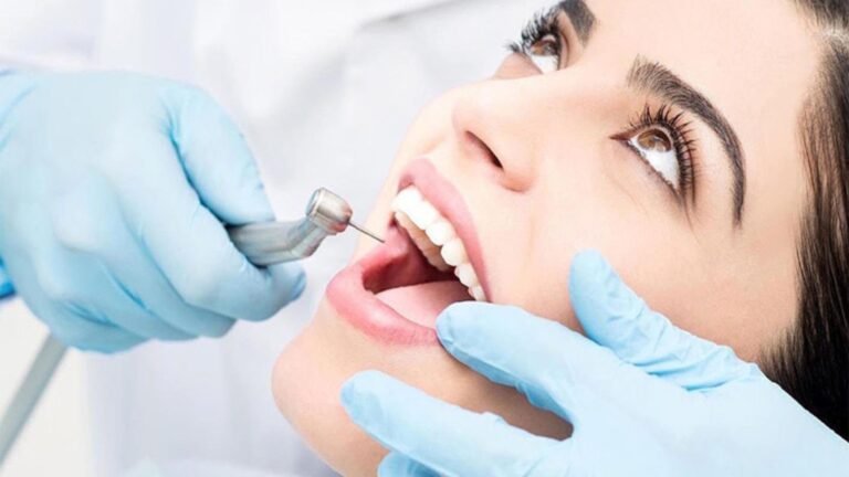 Top Questions to Ask Your Dentist Before Any Procedure