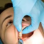 What to Expect During a Wisdom Tooth Extraction