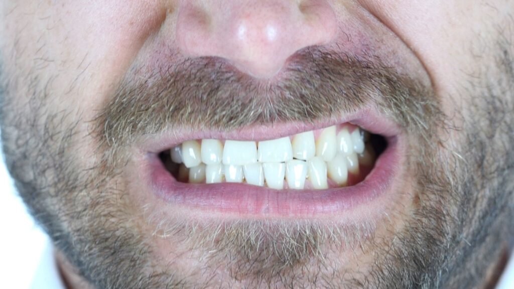How to Avoid Teeth Grinding During a Poker Game
